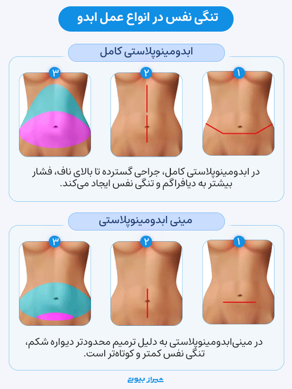 The rate of shortness of breath after various types of abdominoplasty tummy tuck surgeries