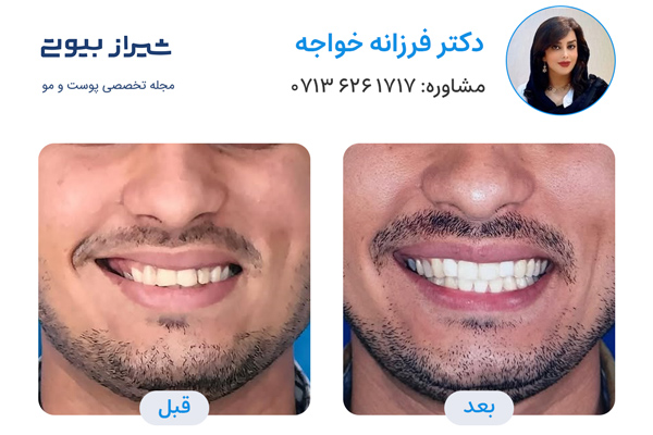 دکتر ارتودنسی در شیراز - دکتر فرزانه خواجه