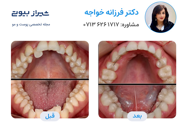 دکتر ارتودنسی در شیراز - دکتر فرزانه خواجه