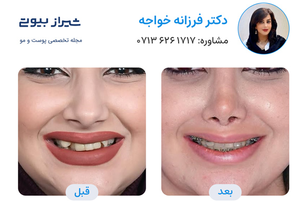 دکتر ارتودنسی در شیراز - دکتر فرزانه خواجه