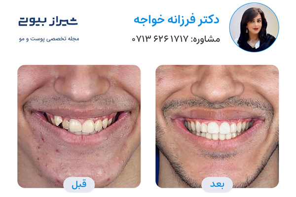 دکتر ارتودنسی در شیراز - دکتر فرزانه خواجه