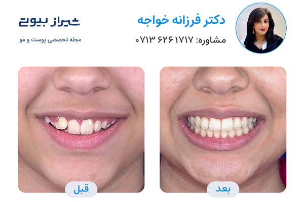 دکتر ارتودنسی در شیراز - دکتر فرزانه خواجه