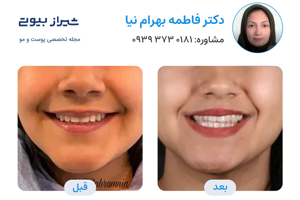 ارتودنسی دندان در شیراز - دکتر فاطمه بهرام نیا