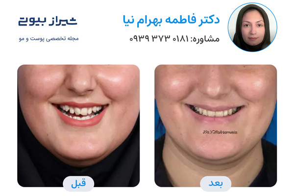 ارتودنسی دندان در شیراز - دکتر فاطمه بهرام نیا