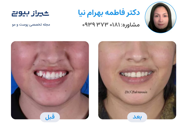 ارتودنسی دندان در شیراز - دکتر فاطمه بهرام نیا