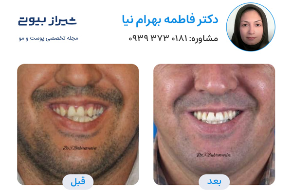 ارتودنسی دندان در شیراز - دکتر فاطمه بهرام نیا