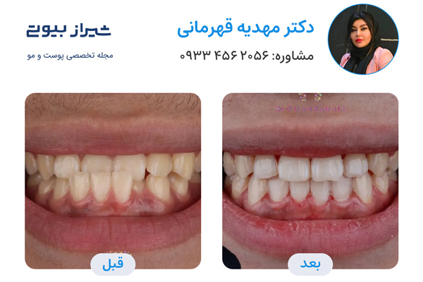 ارتودنسی در شیراز - دکتر مهدیه قهرمانی