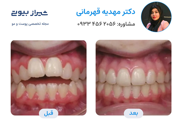 ارتودنسی در شیراز - دکتر مهدیه قهرمانی