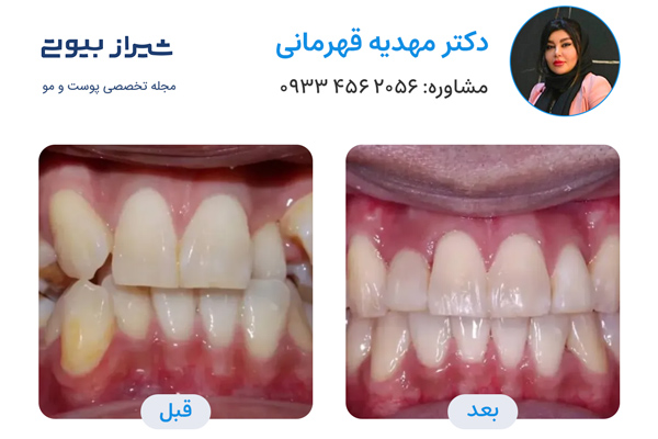 ارتودنسی در شیراز - دکتر مهدیه قهرمانی