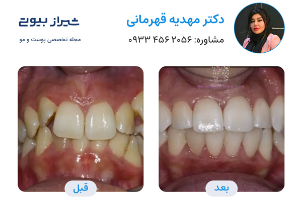 ارتودنسی در شیراز - دکتر مهدیه قهرمانی