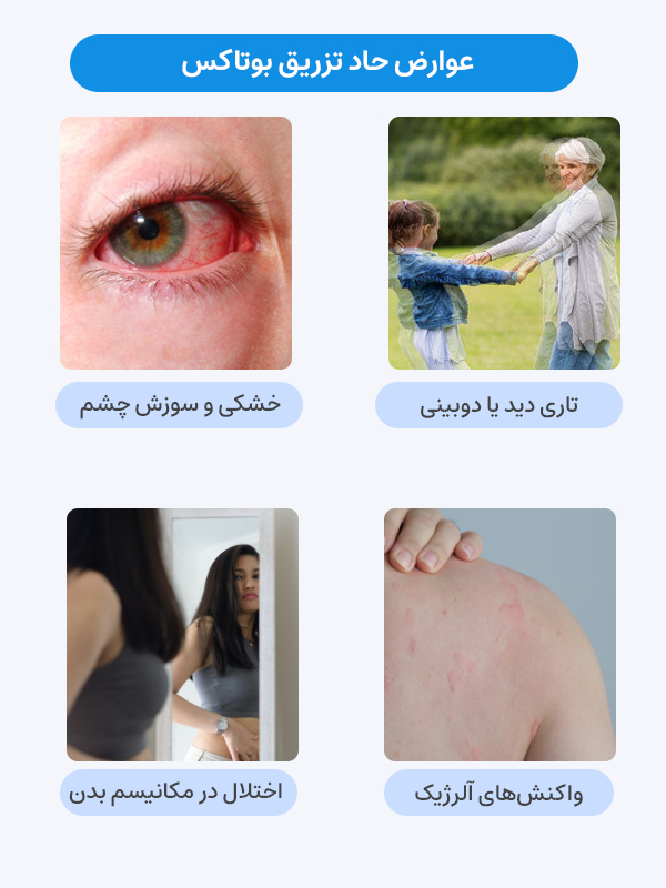 عوارض حاد تزریق بوتاکس