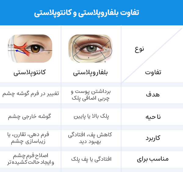 تفاوت کانتوپلاستی و بلفاروپلاستی