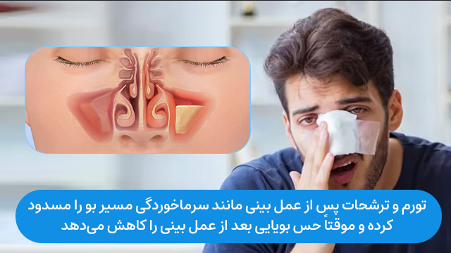 نداشتن حس بویایی بعد از عمل بینی: تورم و التهاب