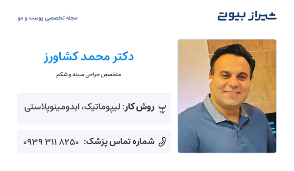 ماموپلاستی در شیراز - دکتر محمد کشاورز