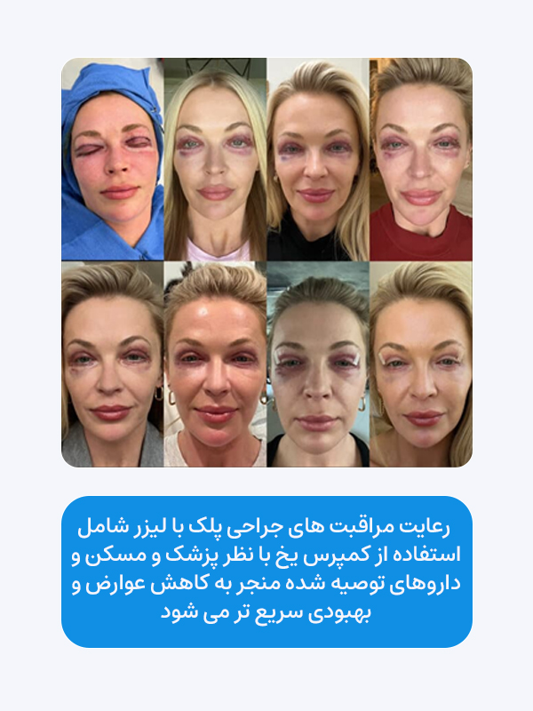 رعایت مراقبت های جراحی پلک با لیزر شامل استفاده از کمپرس یخ با نظر پزشک و مسکن و داروهای توصیه شده منجر به کاهش عوارض و بهبودی سریع تر می شود.