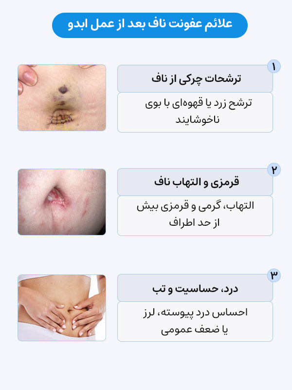 علائم عفونت ناف بعد از ابدومینوپلاستی
