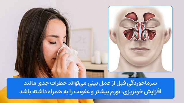 سرماخوردگی قبل از عمل بینی و تاثیر آن در جراحی
