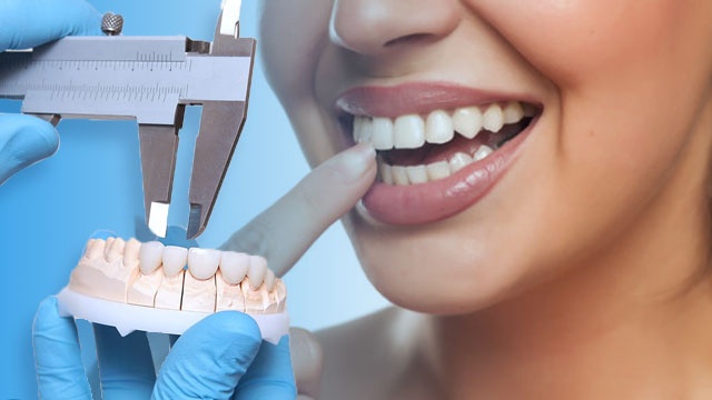 آیا کامپوزیت باعث جلو آمدن دندان میشود؟