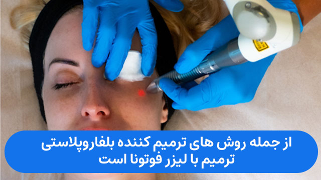 از جمله روش های ترمیم کننده بلفاروپلاستی، ترمیم با لیزر فوتونا است.