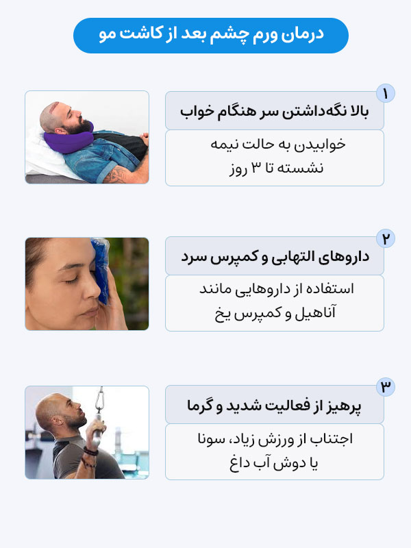 درمان ورم چشم بعد از کاشت مو