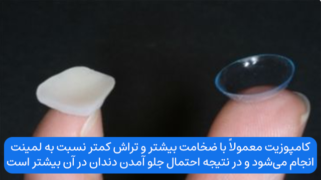 کامپوزیت معمولاً با ضخامت بیشتر و تراش کمتر نسبت به لمینت انجام میشود و در نتیجه احتمال جلو آمدن دندان در آن بیشتر است.