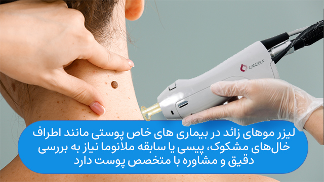 لیزر موهای زائد در بیماری های خاص پوستی مانند اطراف خالهای مشکوک، پیسی یا سابقه ملانوما نیاز به بررسی دقیق و مشاوره با متخصص پوست دارد.