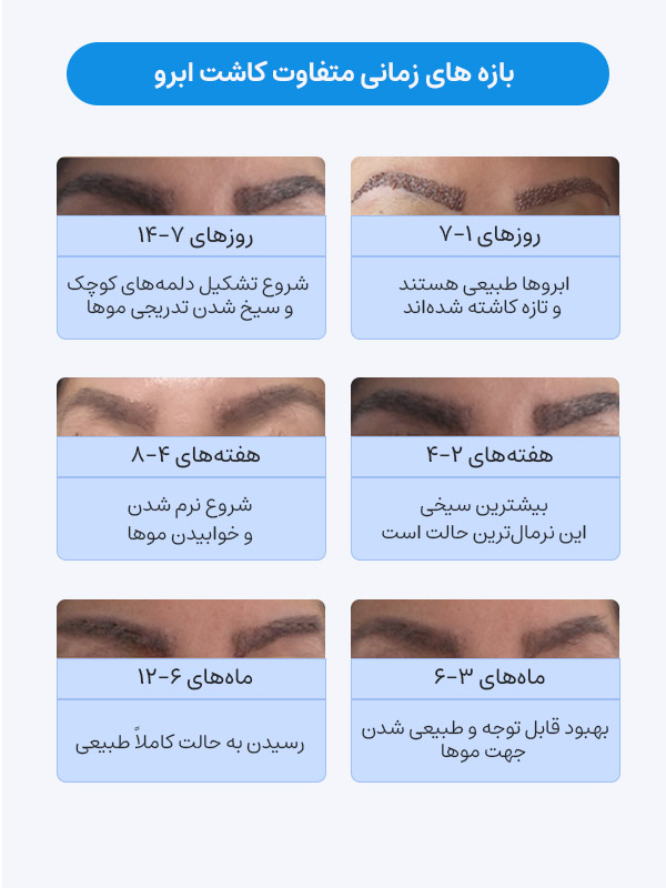 بازه های زمانی متفاوت کاشت ابرو