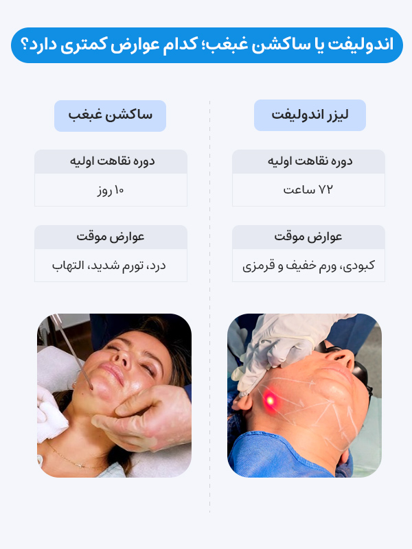 مقایسه عوارض اندولیفت غبغب و ساکشن غبغب