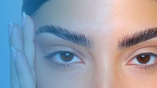 سیخ شدن ابرو بعد کاشت