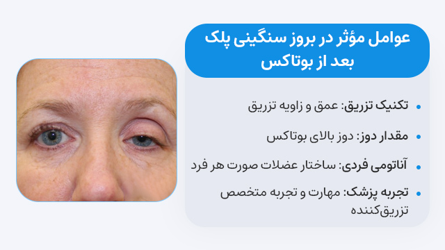 عوامل مؤثر در بروز سنگینی پلک بعد از بوتاکس