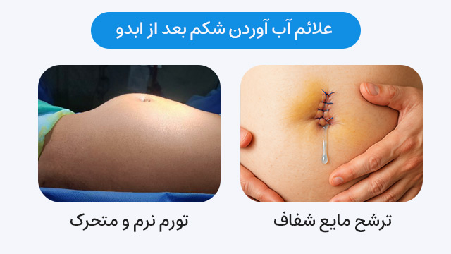 علائم آب آوردن شکم بعد از ابدو