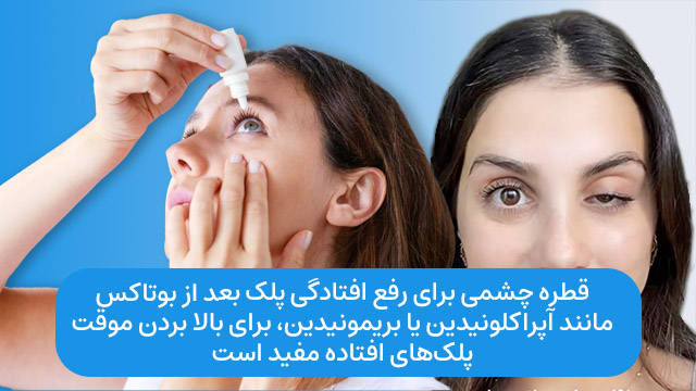 قطره چشمی برای رفع افتادگی پلک بعد از بوتاکس