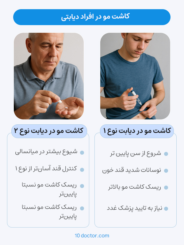 کاشت مو در افراد دیابتی