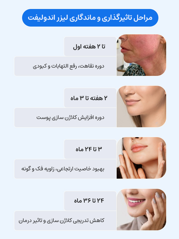 اندولیفت چند سال ماندگاری دارد؟