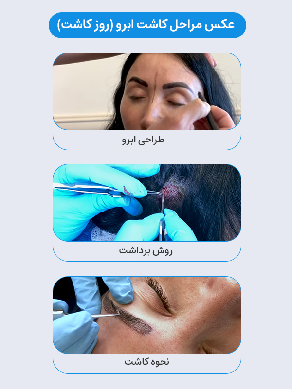 عکس مراحل کاشت ابرو