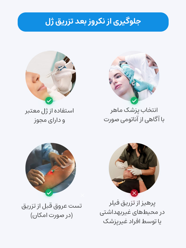 چگونه از نکروز بعد از تزریق ژل جلوگیری کنیم؟
