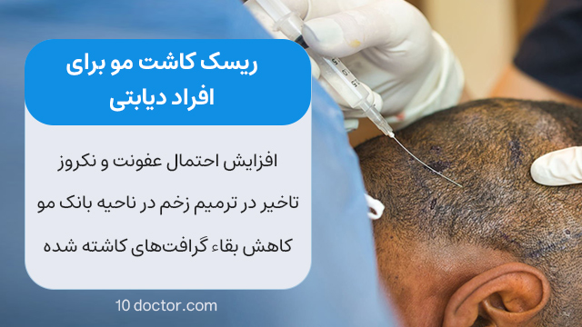 ریسک کاشت مو برای افراد دیابتی