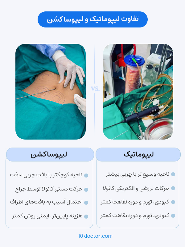 The difference between lipomatics and liposuction