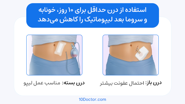 استفاده از درن حداقل برای 10 روز، خونابه و سروما بعد لیپوماتیک را کاهش می‌دهد.