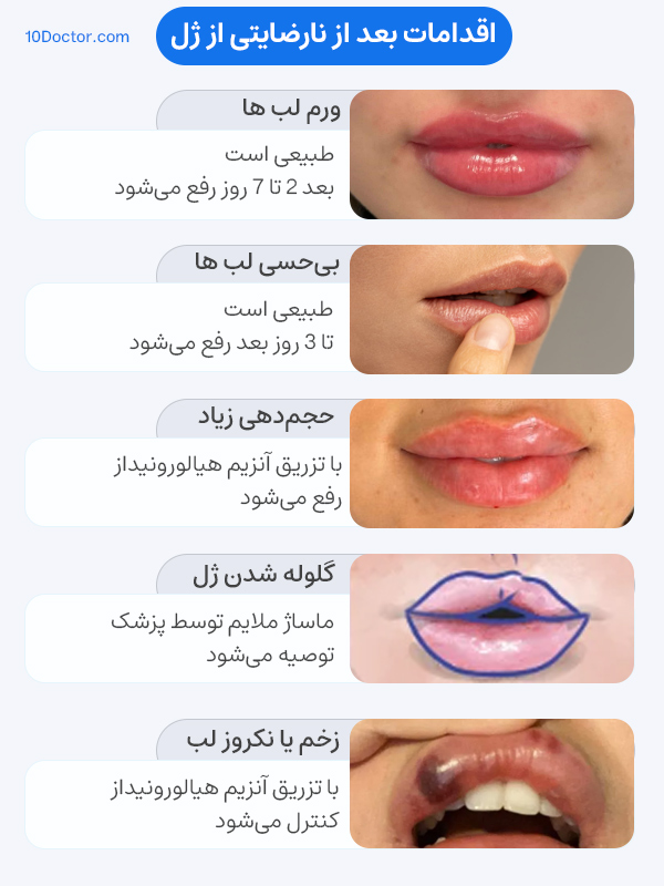 پشیمانی بعد از تزریق ژل لب؛ چرا اتفاق می‌افتد؟