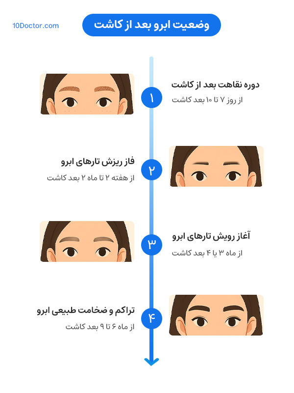 وضعیت ابرو بعد از کاشت