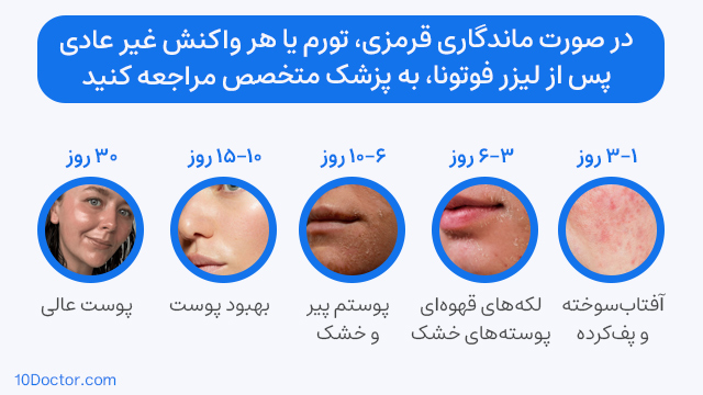 در صورت ماندگاری قرمزی، تورم یا هر واکنش غیر عادی پس از لیزر فوتونا، به پزشک متخصص مراجعه کنید.