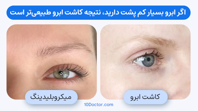 کاندیدای مناسب کاشت ابرو و میکروبلیدینگ