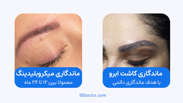 ماندگاری کدام روش بیشتر است؛ کاشت ابرو یا میکروبلیدینگ؟