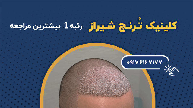 banner toranj