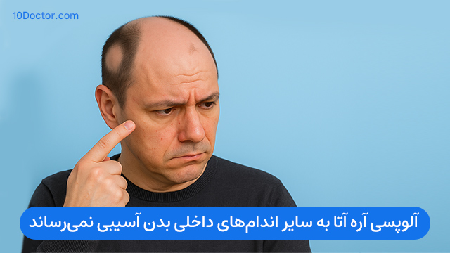 آلوپسی آره آتا به سایر اندامهای داخلی بدن آسیبی نمیرساند.