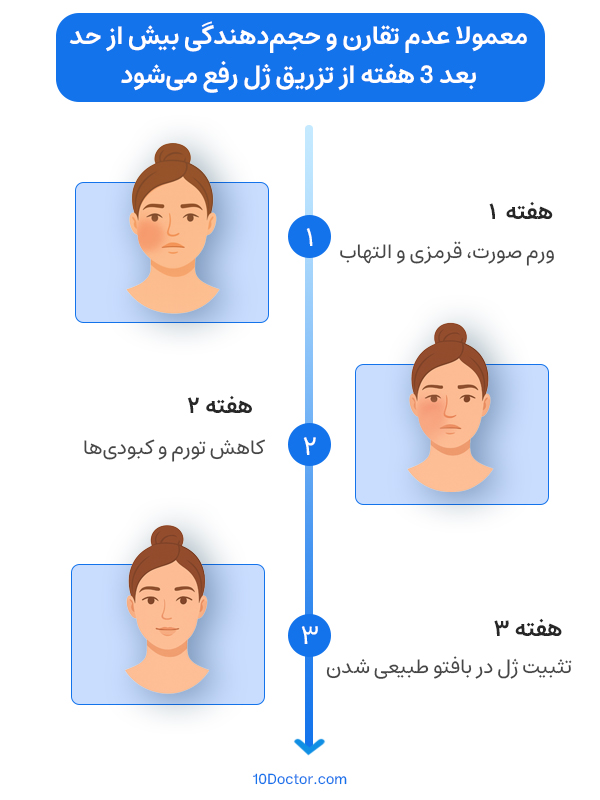 معمولا عدم تقارن و حجم‌دهندگی بیش از حد بعد 3 هفته از تزریق ژل رفع می‌شود.
هفته اول: ورم صورت، قرمزی و التهاب
هفته دوم: کاهش تورم و کبودی‌ها
هفته سوم: تثبیت ژل در بافت و طبیعی شدن
