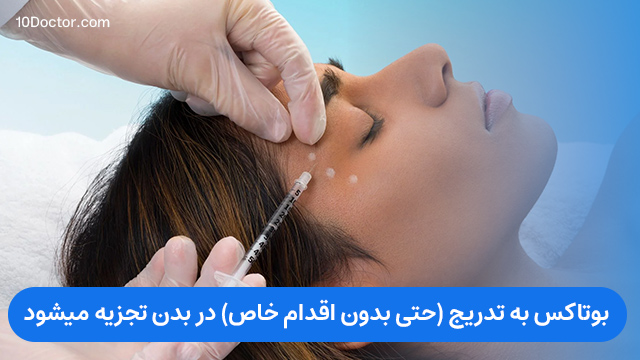 بوتاکس به تدریج (حتی بدون اقدام خاص) در بدن تجزیه میشود.