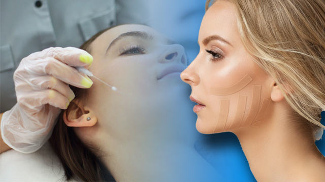 چسب زدن بعد از لیفت با نخ