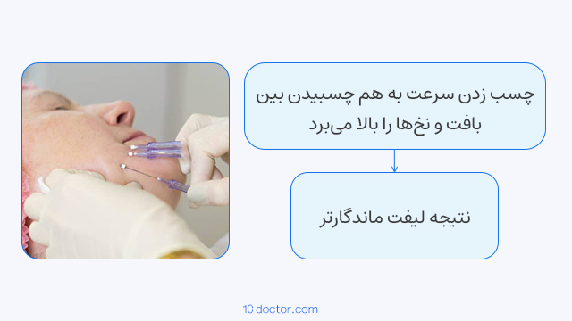 چسب زدن سرعت به هم چسبیدن بین بافت و نخ‌ها را بالا می‌برد.